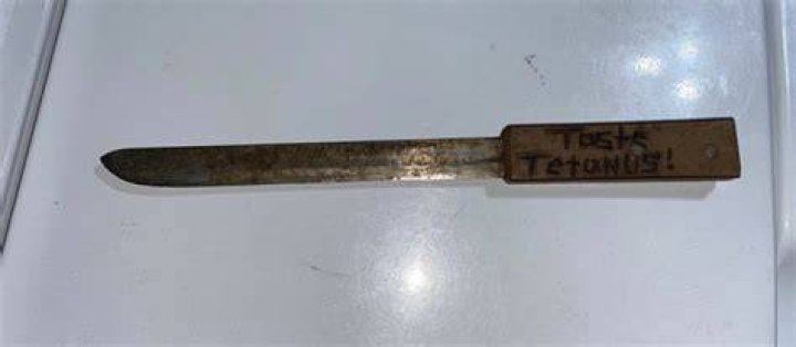 Can a kitchen knife give you tetanus?