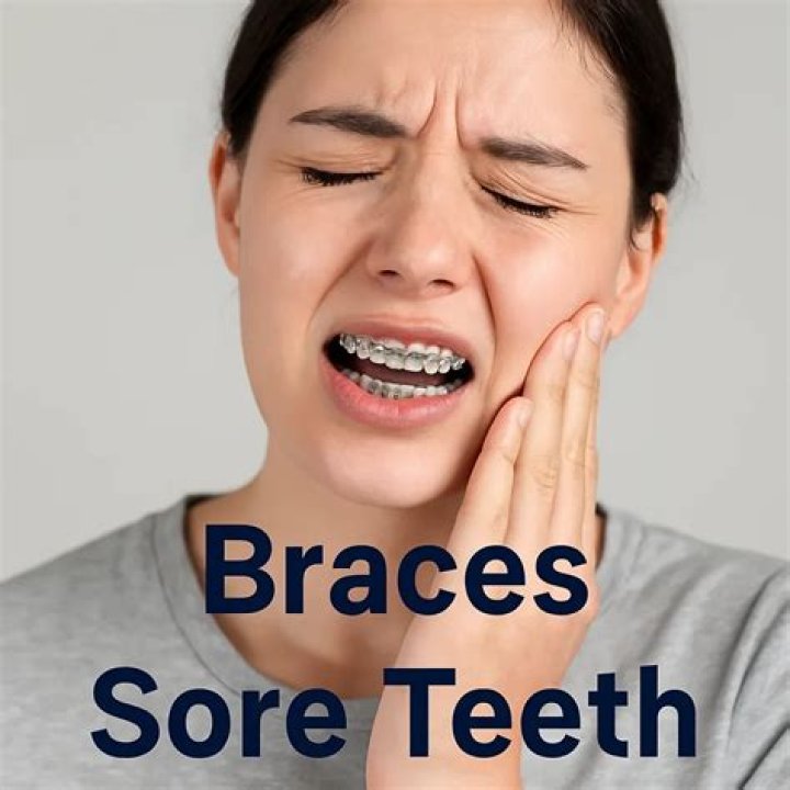 How sore are kids after getting braces?