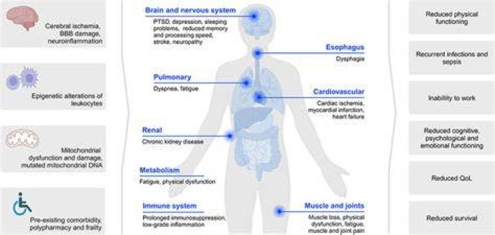 What is Post-sepsis syndrome?